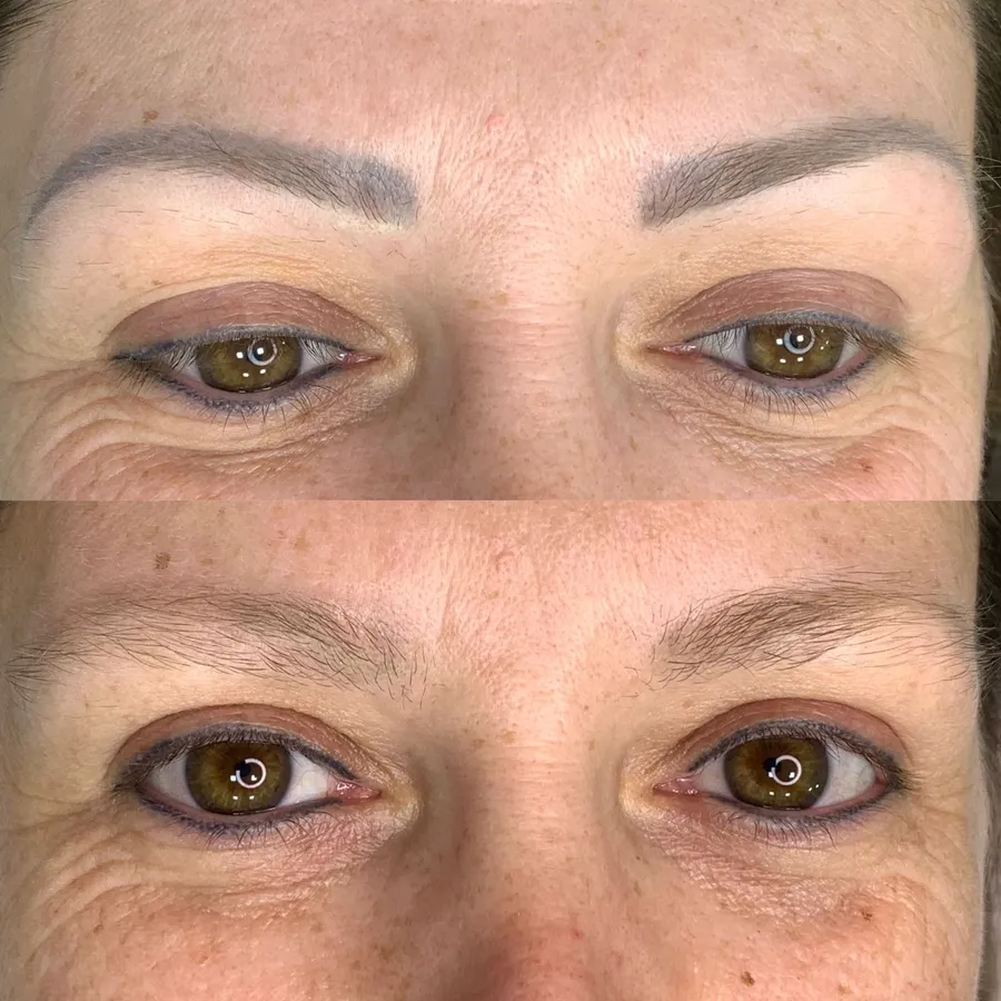 Antes e depois — sobrancelhas com micropigmentação corrigida
